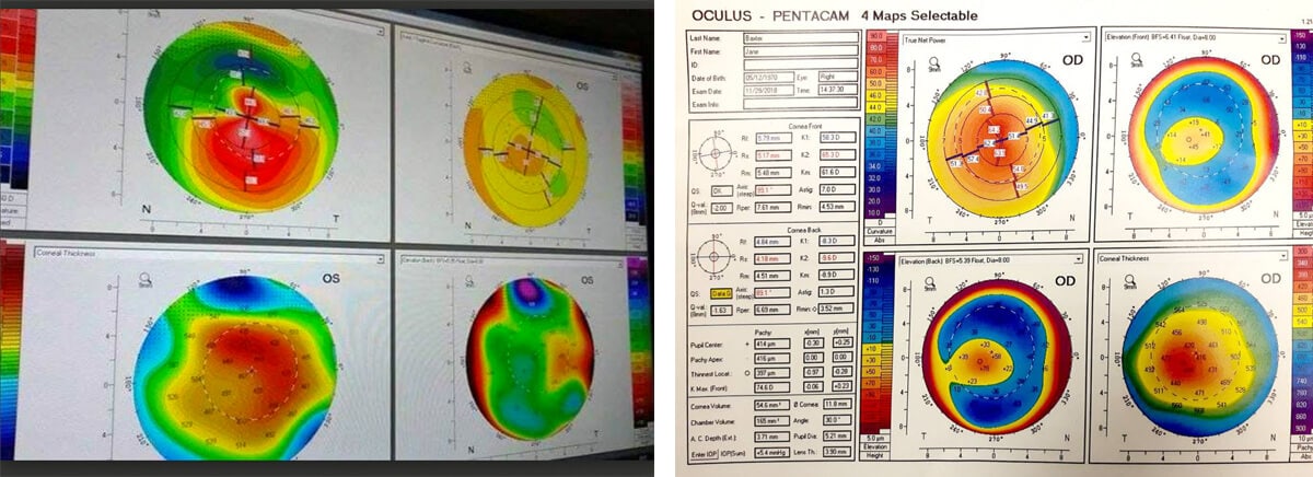 Topography Scans