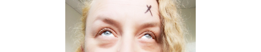 X marks the spot, above right eye, phew!