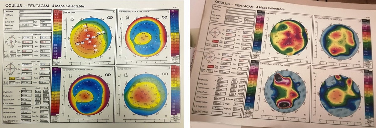 Spot the difference Topography comparison