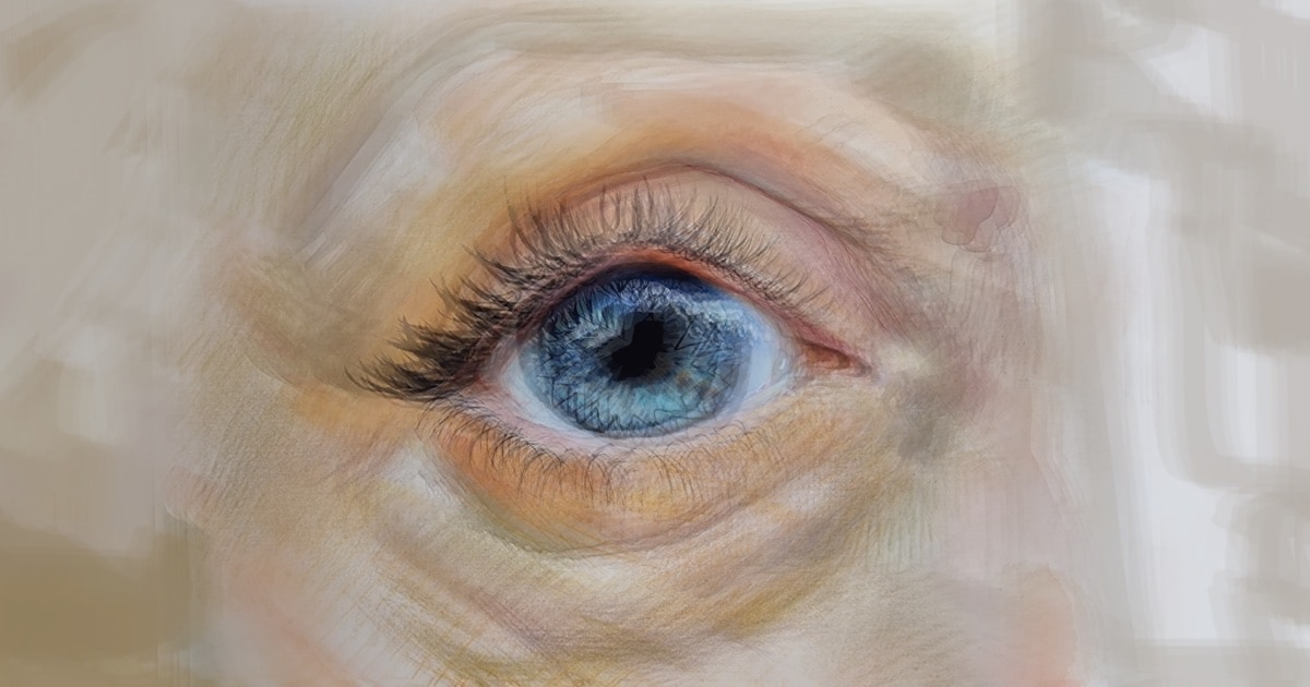 Picture showing what keratoconus kc vision is like - painting of an eye
