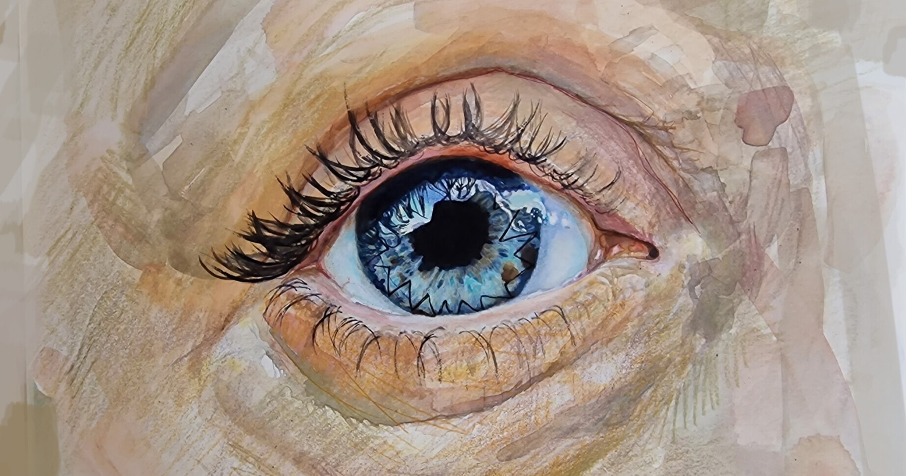 Watercolour and pen painting of an eye with a cornea transplant - showing the stitches